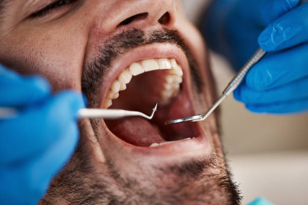Best Holiday Emergency Dentist in Ormond By The Sea, FL