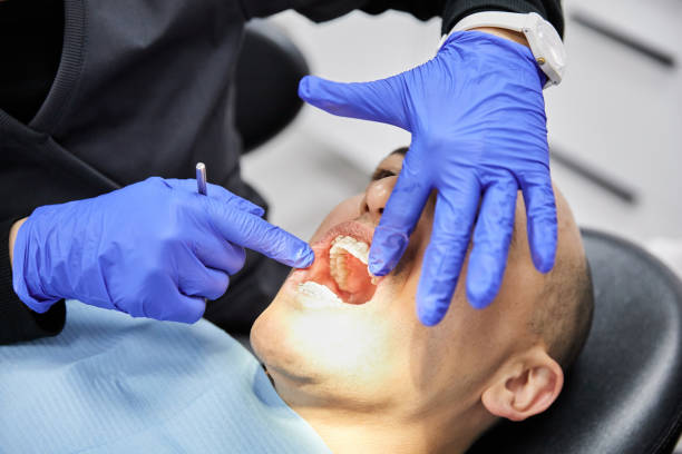 Best Emergency Dental Care for Abscessed Tooth in Ormond By The Sea, FL